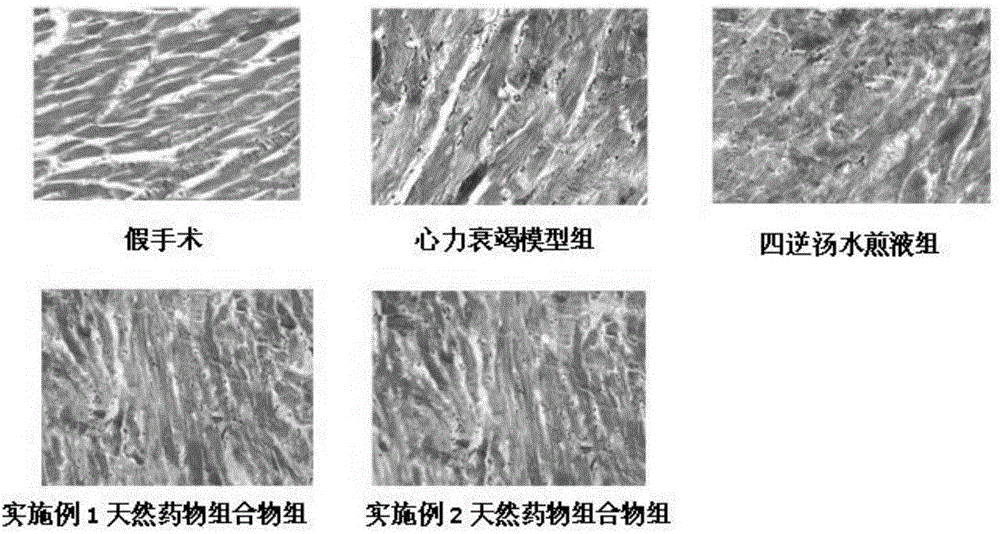 Natural medicine composition used for treating cardiovascular diseases