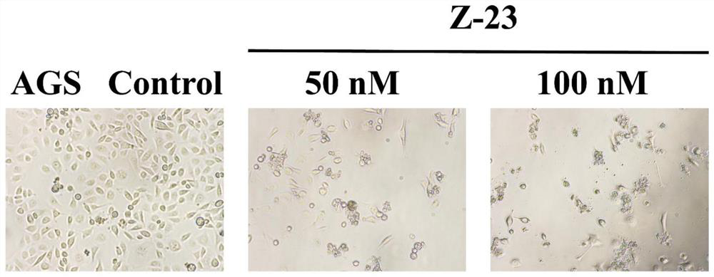 Application of neocryptolepine derivative in preparation of medicine for treating gastric cancer