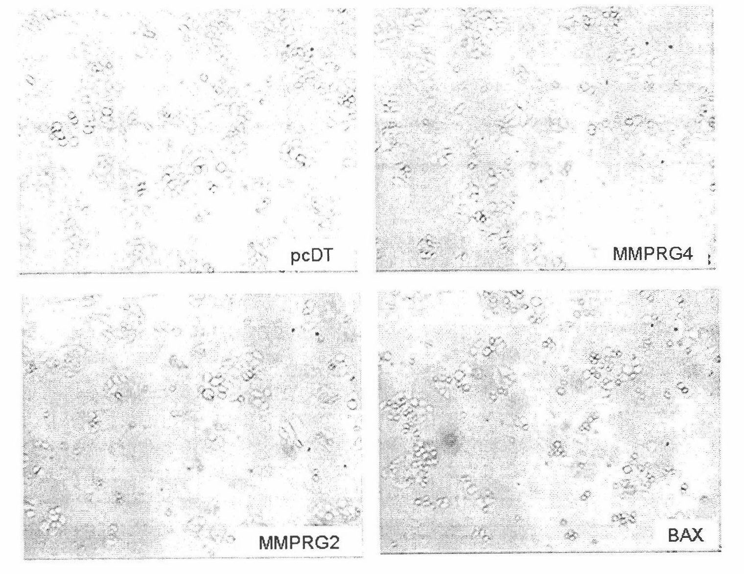 Polynucleotide related to mitochondrial membrane potential decrease and coded polypeptide and application thereof