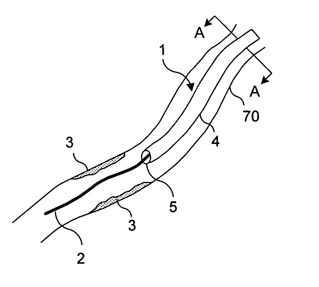 Light generating device that self centers within a lumen to render photodynamic therapy