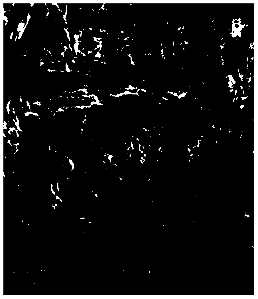 Microporous RTM (regenerative tissue matrix) as well as preparation and application thereof