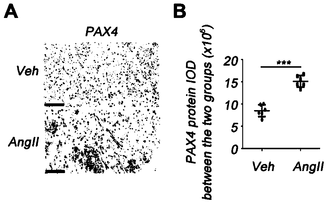 Application of PAX4 gene expression inhibitor to preparation of medicines for restraining fibrosis