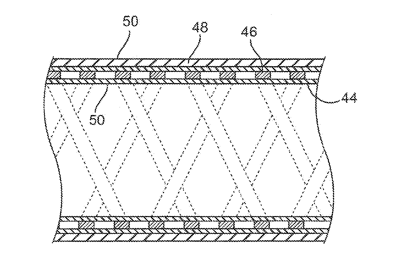 Devices and methods for accessing a cerebral vessel