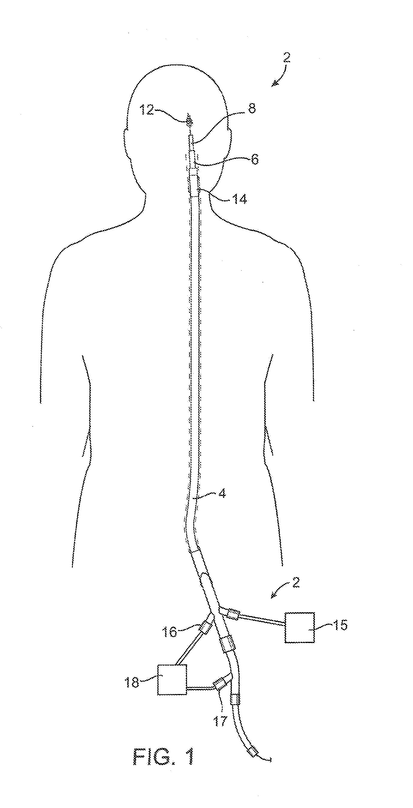 Devices and methods for accessing a cerebral vessel