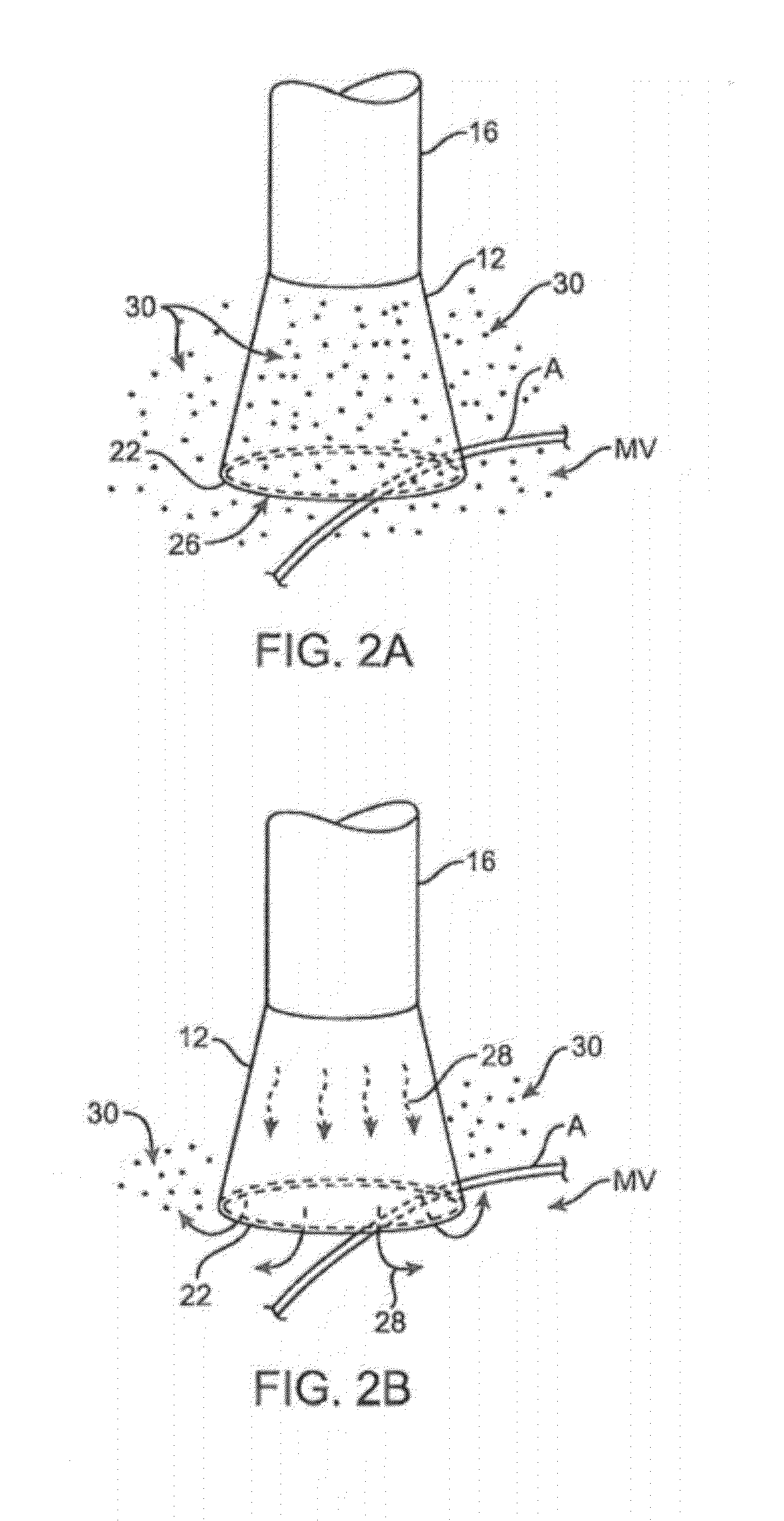 Apparatus and methods for ablation efficacy