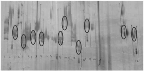 SSR molecular marker in linkage with radish clubroot-resisting QTL and applications of SSR molecular marker