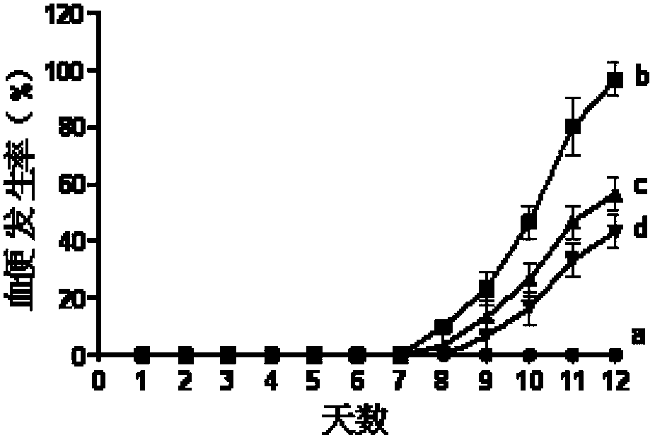 New use of notoginsenoside R1