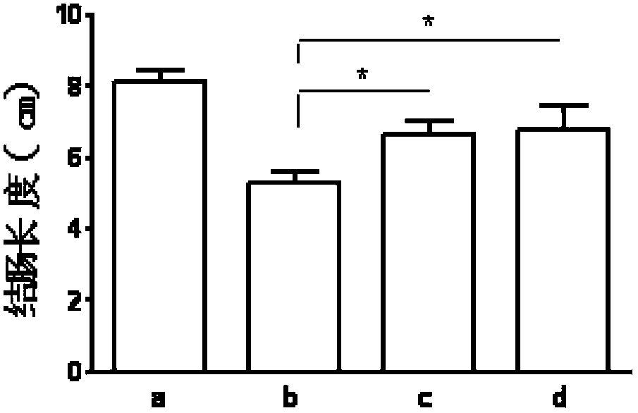 New use of notoginsenoside R1