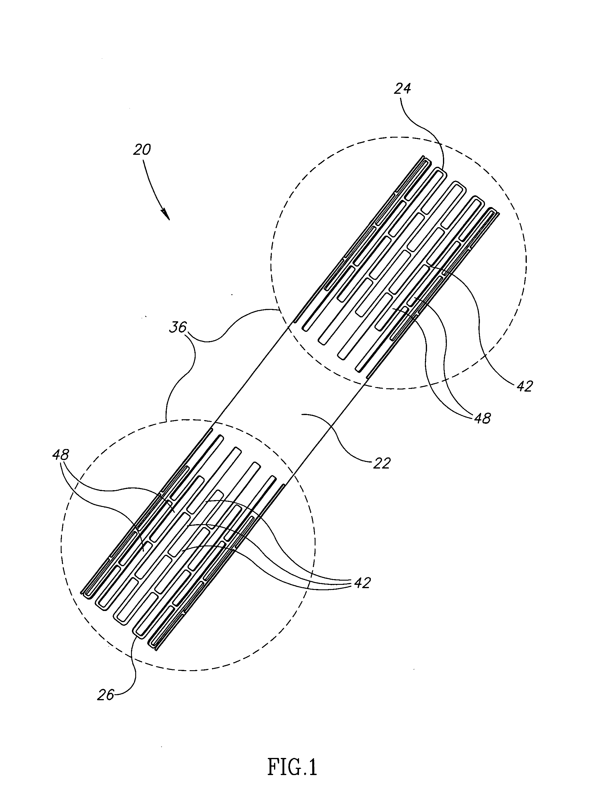 Device and method for treating ischemic heart disease