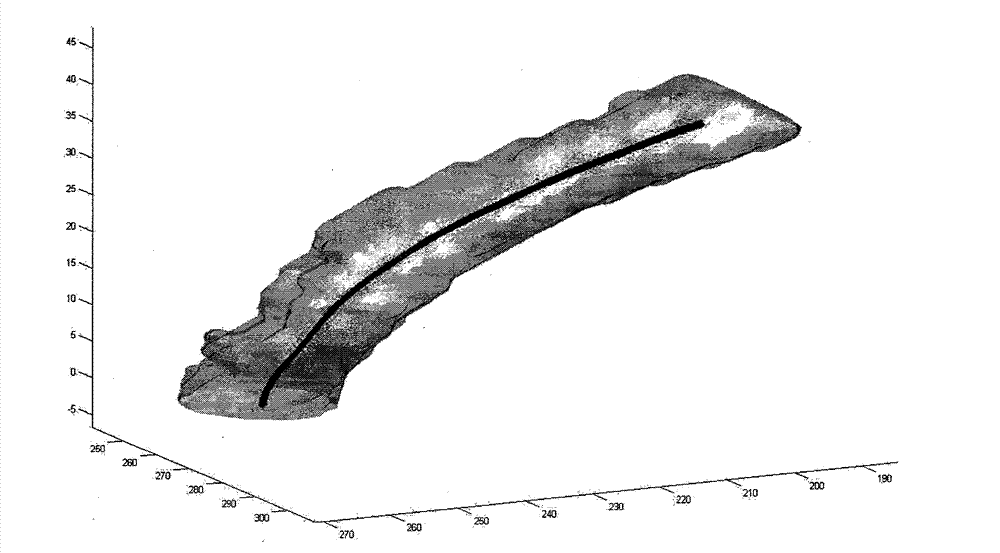 Image simulation method for intracranial aneurysm interventional therapy stent implantation