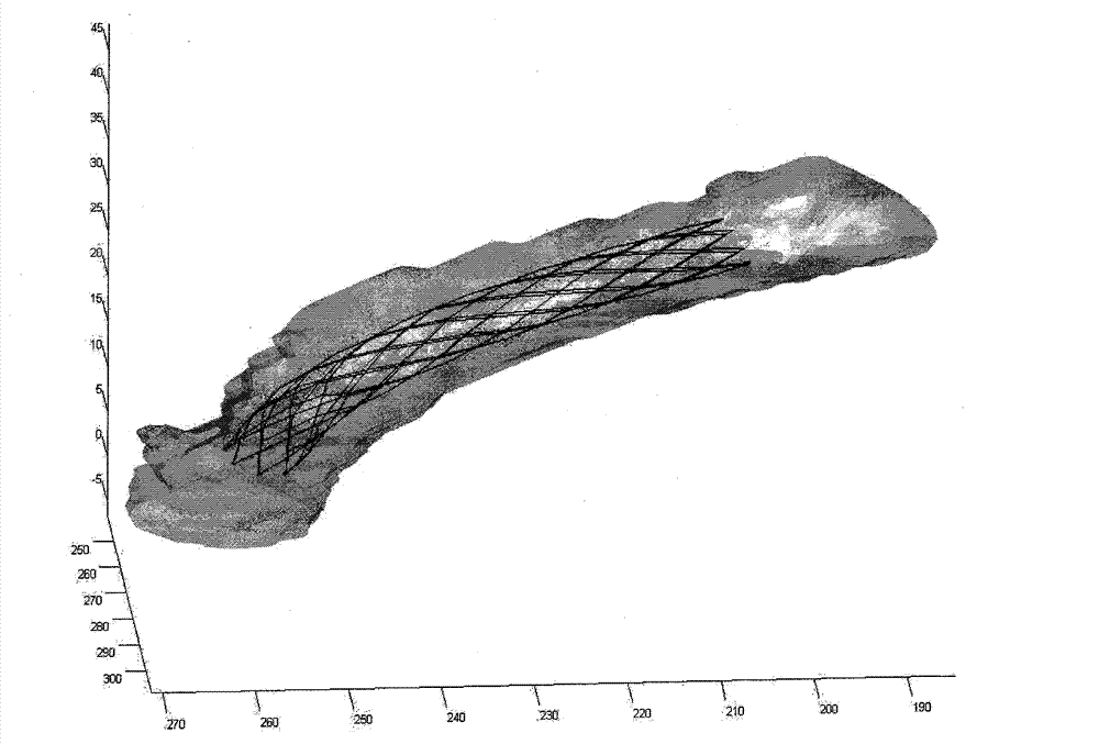 Image simulation method for intracranial aneurysm interventional therapy stent implantation