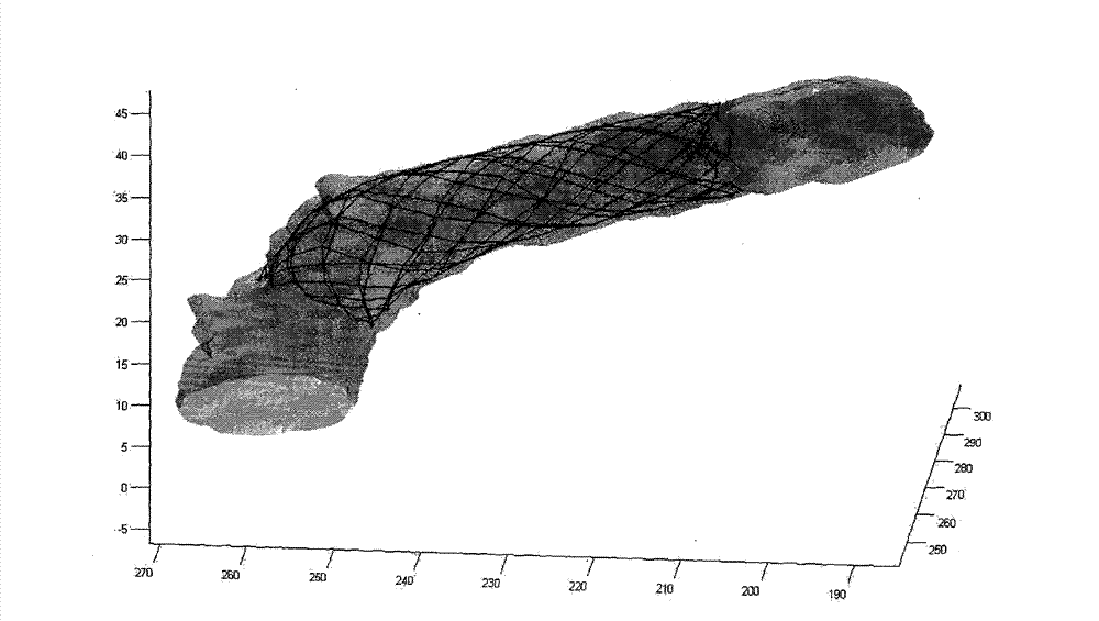 Image simulation method for intracranial aneurysm interventional therapy stent implantation