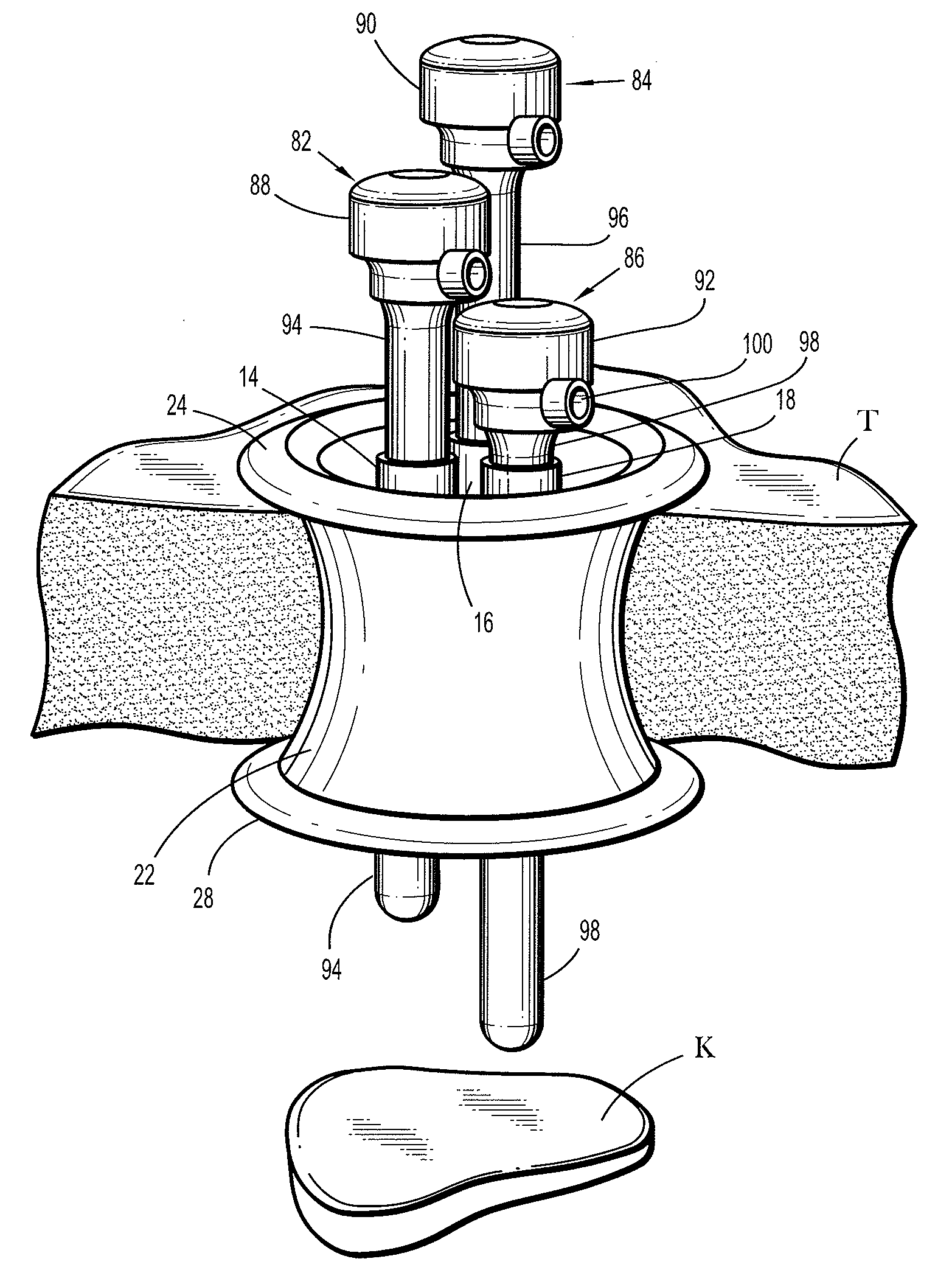 Flexible port seal