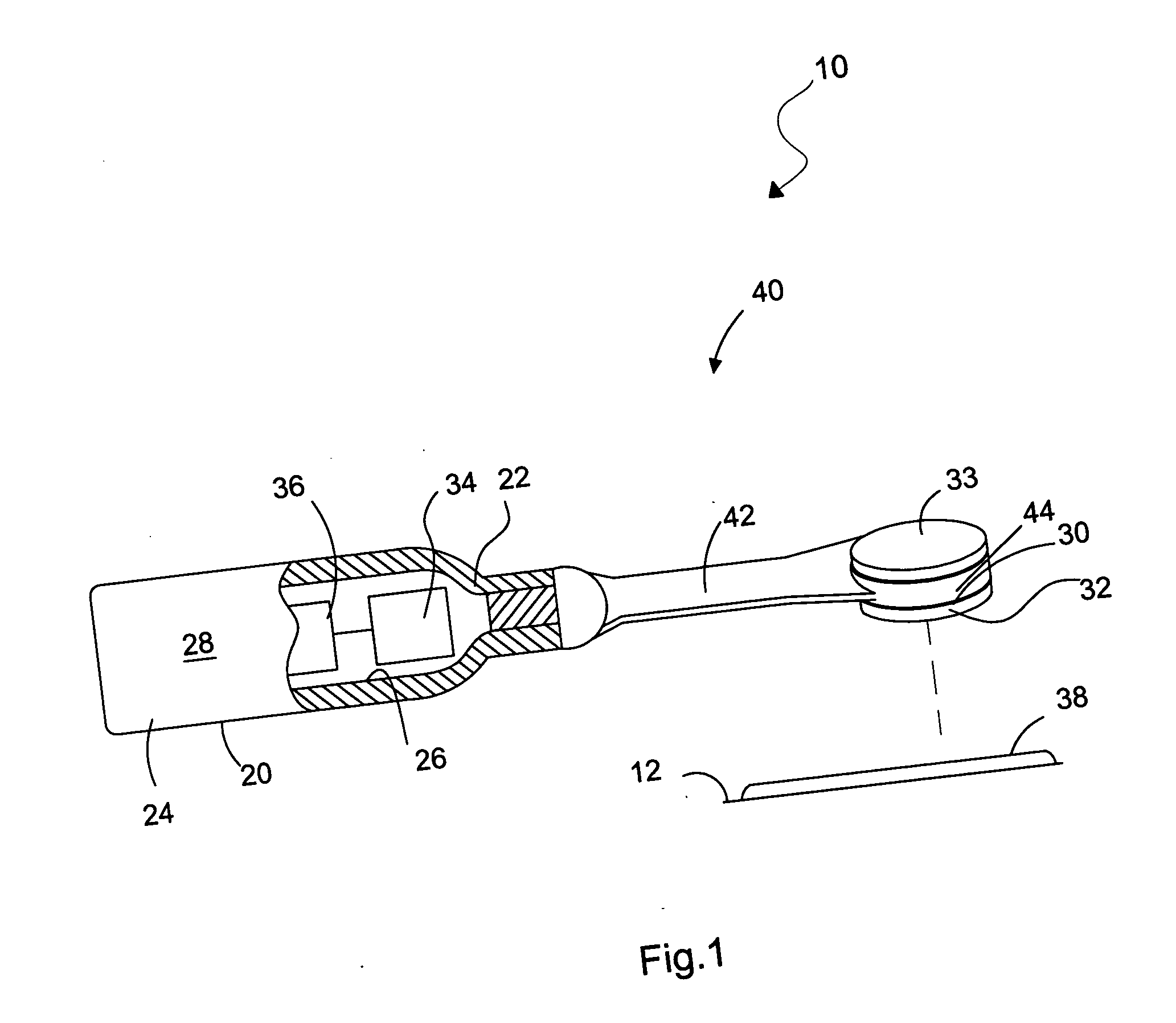 Method for performing dermabrasion