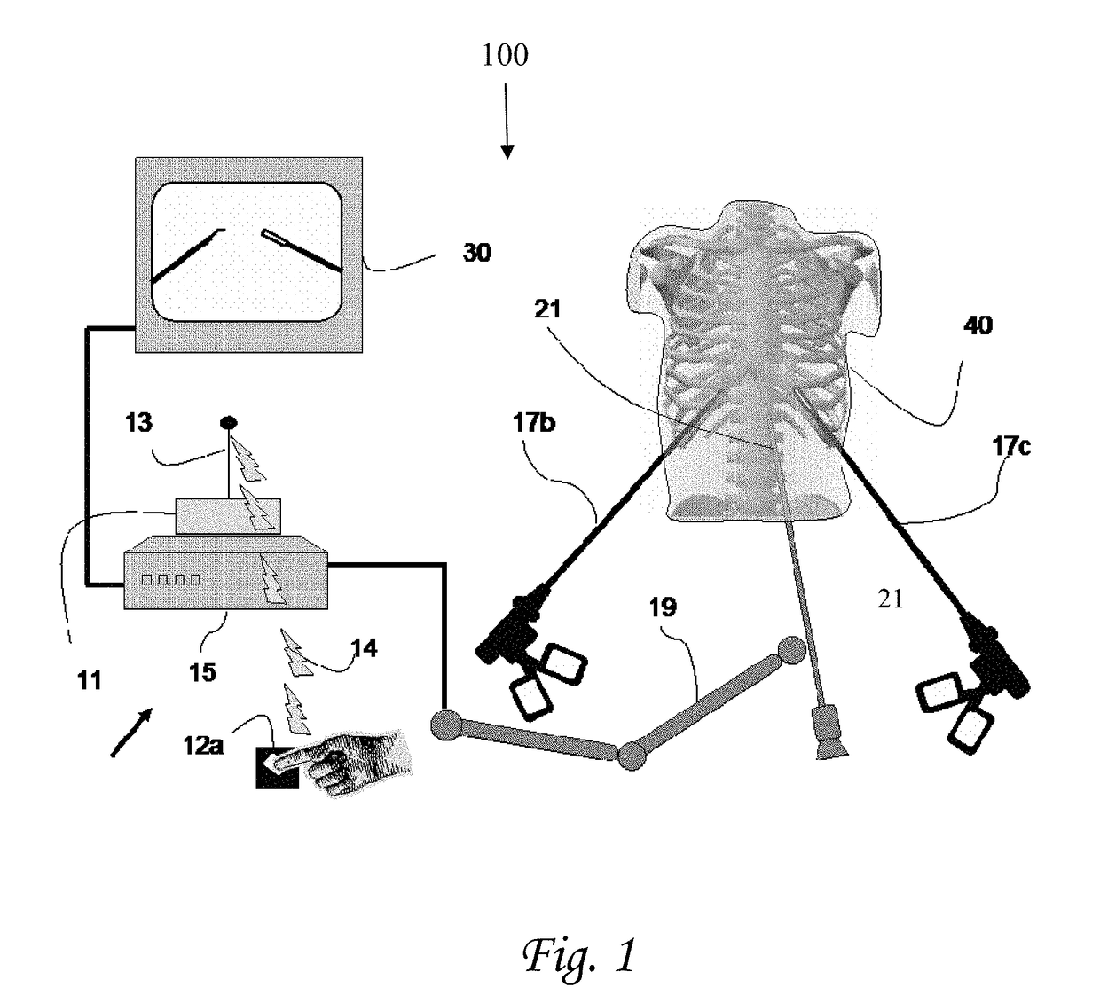 Device and method for assisting laparoscopic surgery—rule based approach