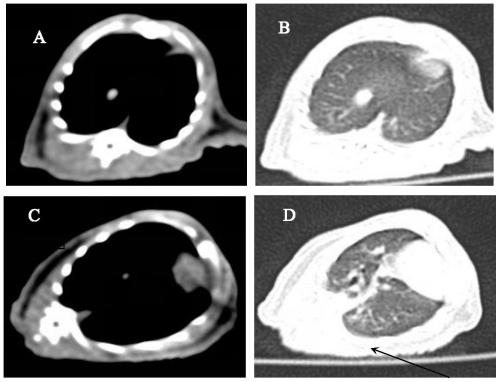 Use of a recombinant human cell line protein in the preparation of drugs for preventing or treating pulmonary fibrosis