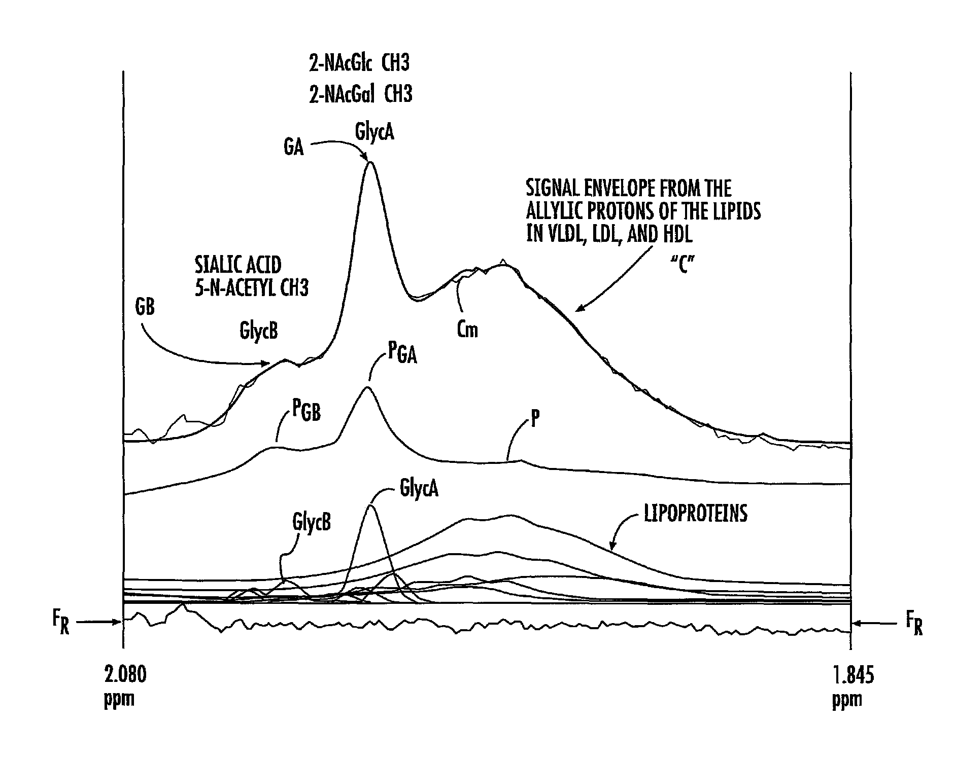 NMR measurements of NMR biomarker GlycA