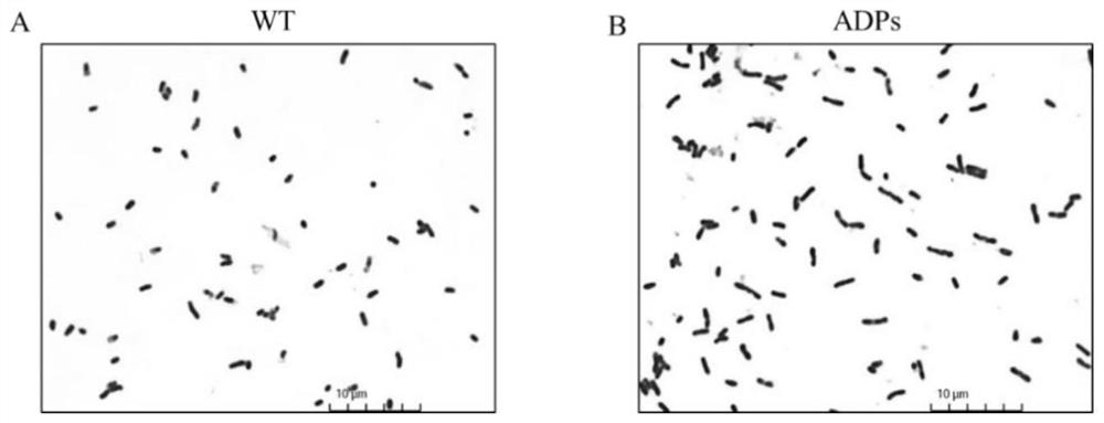 Artificial tandem polypeptide ADPs for improving nitrogen fixation efficiency of rhizobium, expression vector and construction and application of recombinant rhizobium