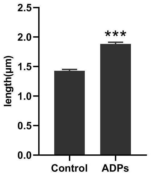 Artificial tandem polypeptide ADPs for improving nitrogen fixation efficiency of rhizobium, expression vector and construction and application of recombinant rhizobium