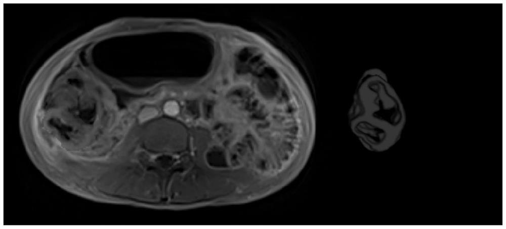 Crohn disease fibrosis grading method based on multi-sequence MRI (Magnetic Resonance Imaging) and related equipment