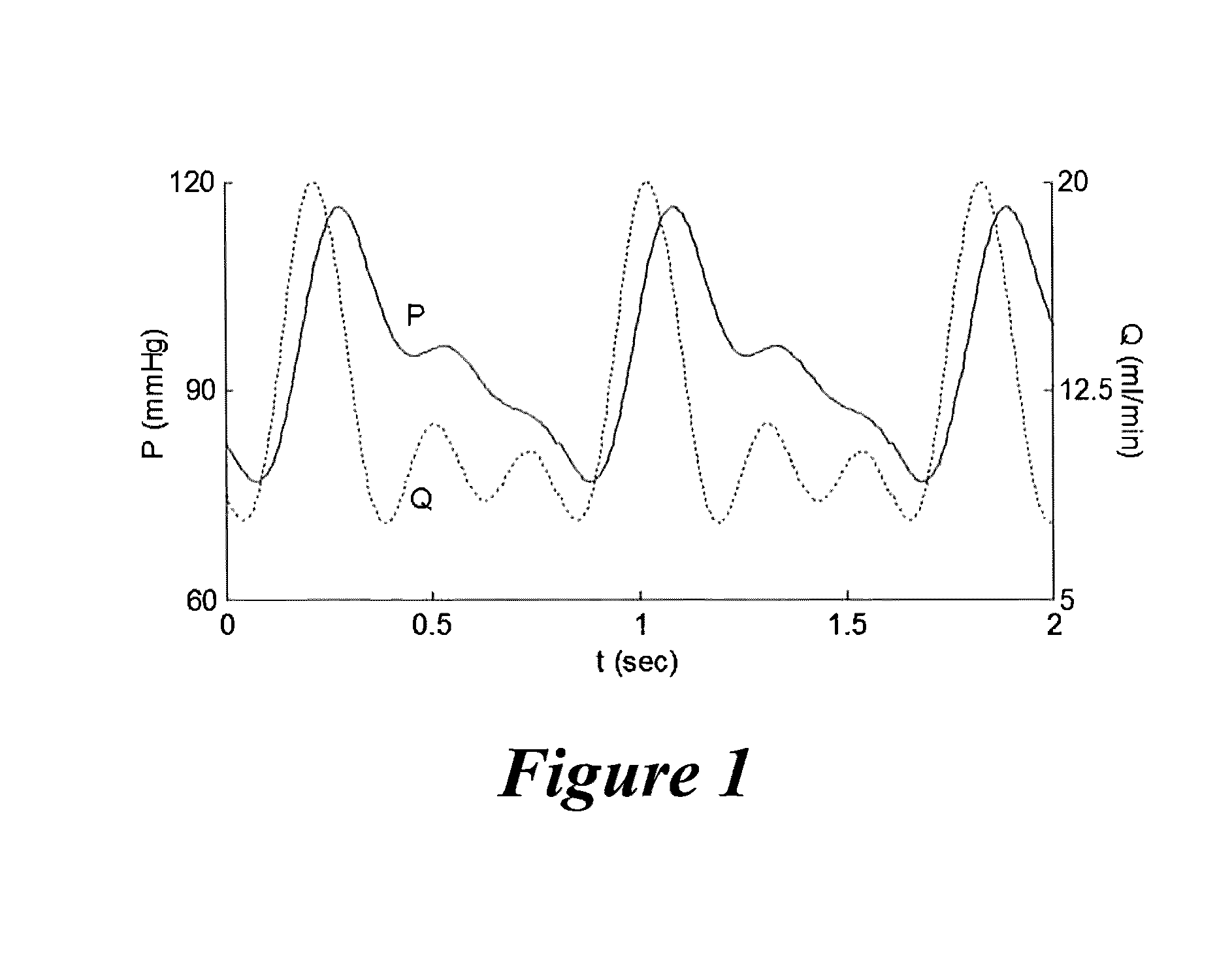 Pulsatile Perfusion Bioreactor for Mimicking, Controlling, and Optimizing Blood Vessel Mechanics