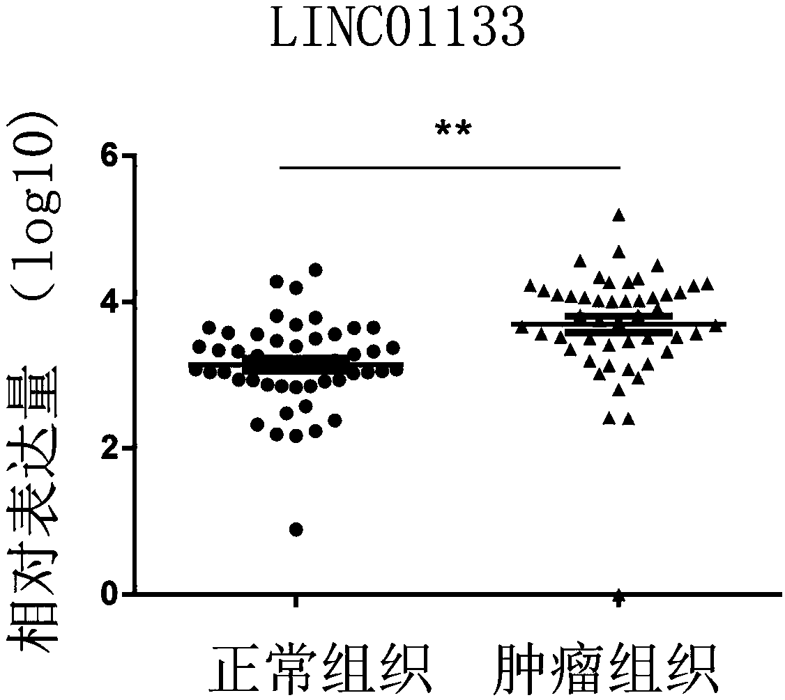 Pancreatic duct adenocarcinoma marker and application thereof