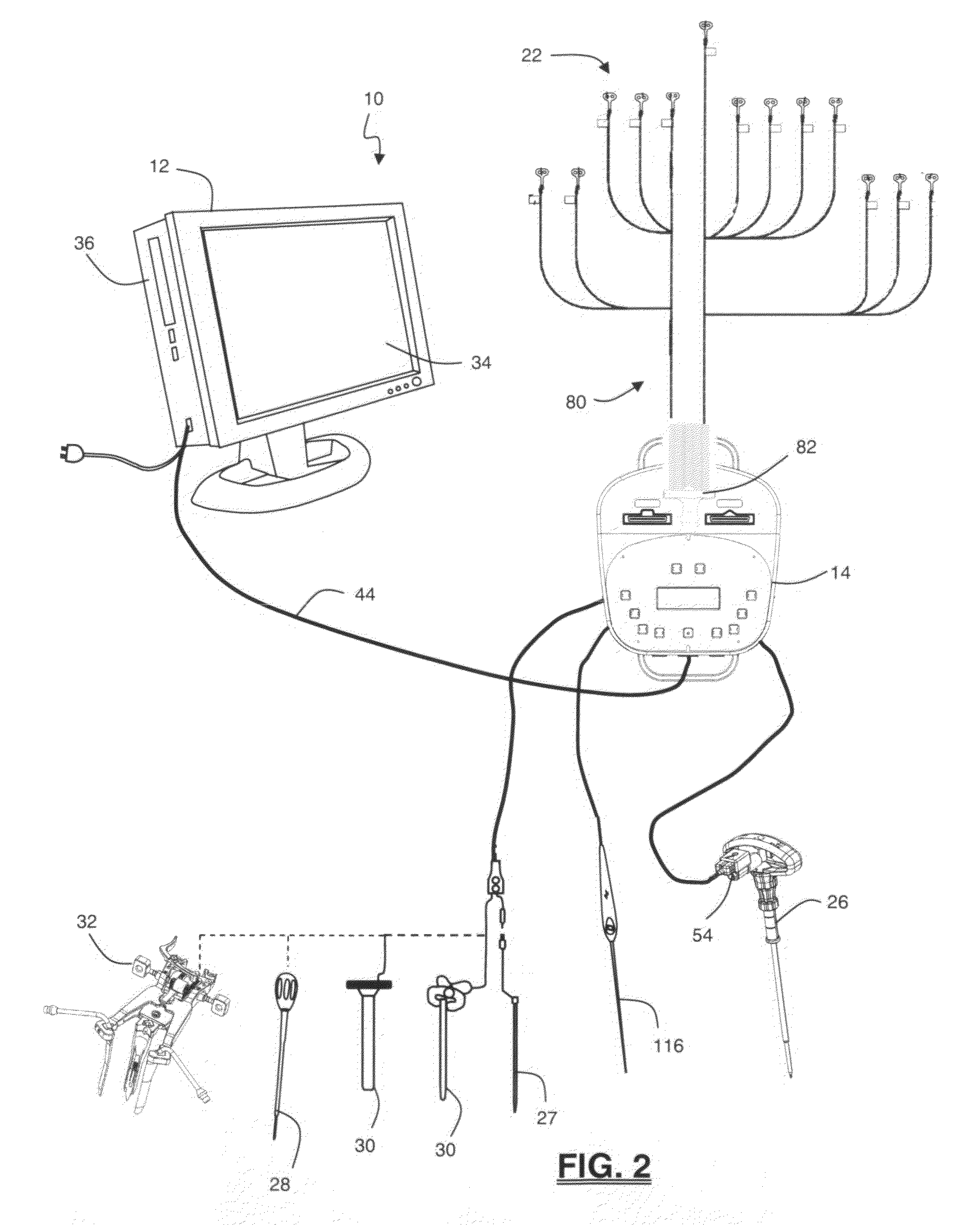 Neurophysiologic monitoring system