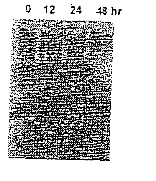 Novel endonuclease of immune cell, process for producing the same and immune adjuvant using the same