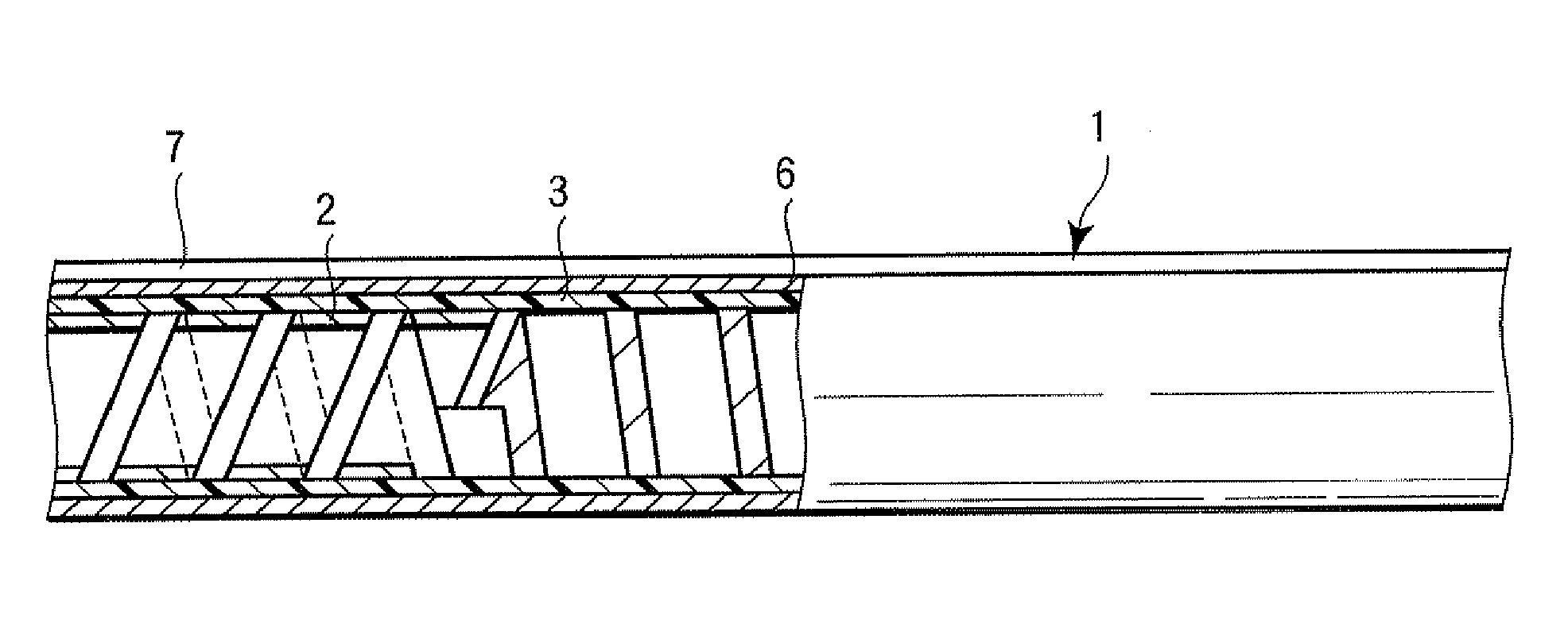 Elastomer molding for endoscope