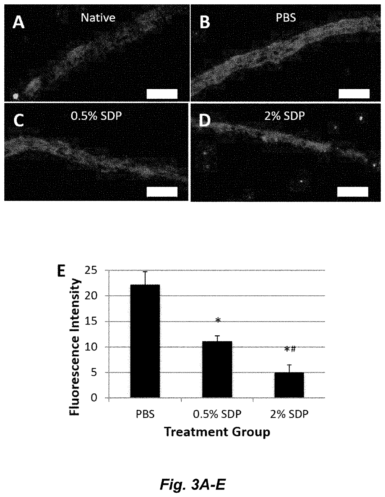 Silk-derived protein for treating inflammation