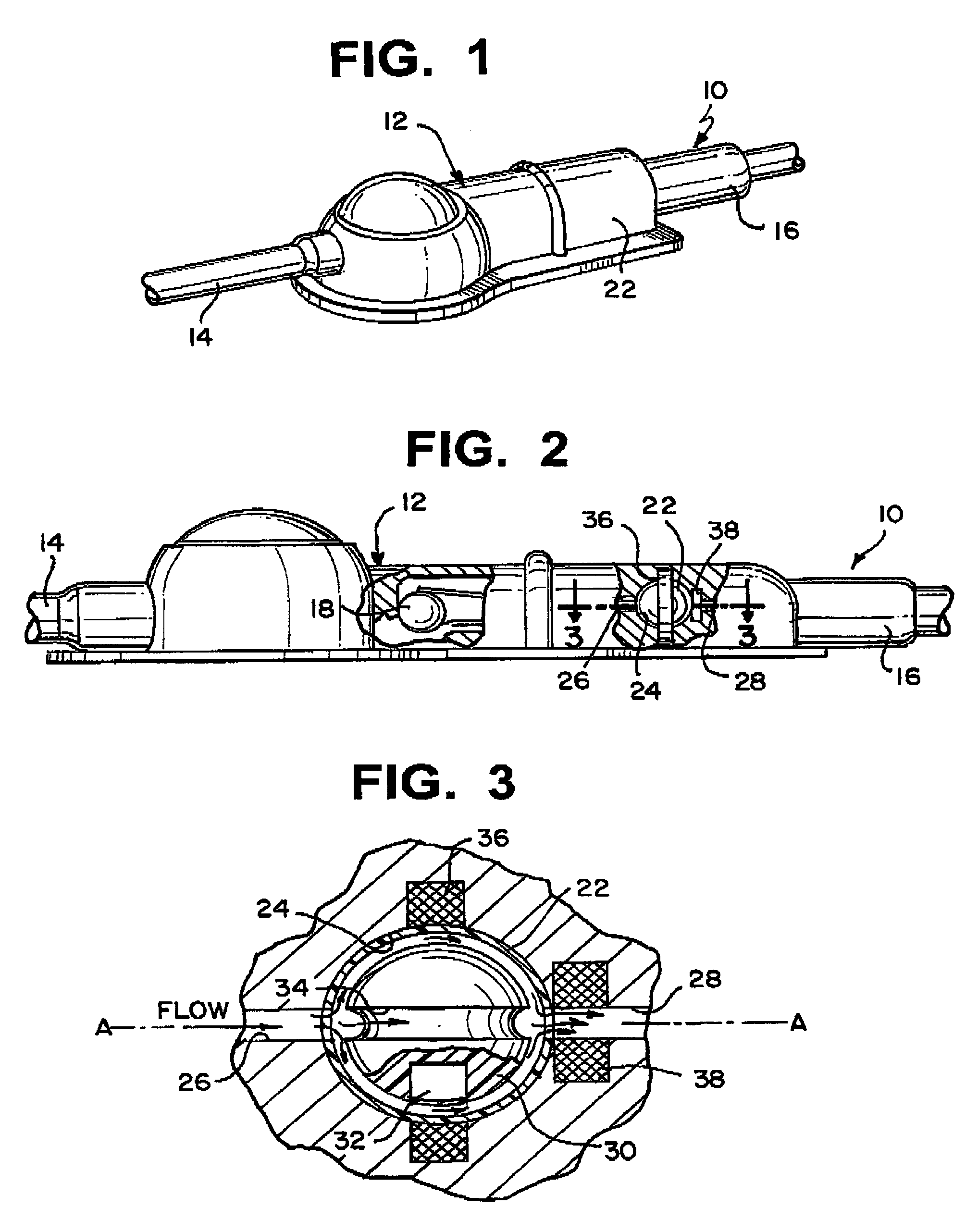 Shunt system including a flow control device for controlling the flow of cerebrospinal fluid out of a brain ventricle