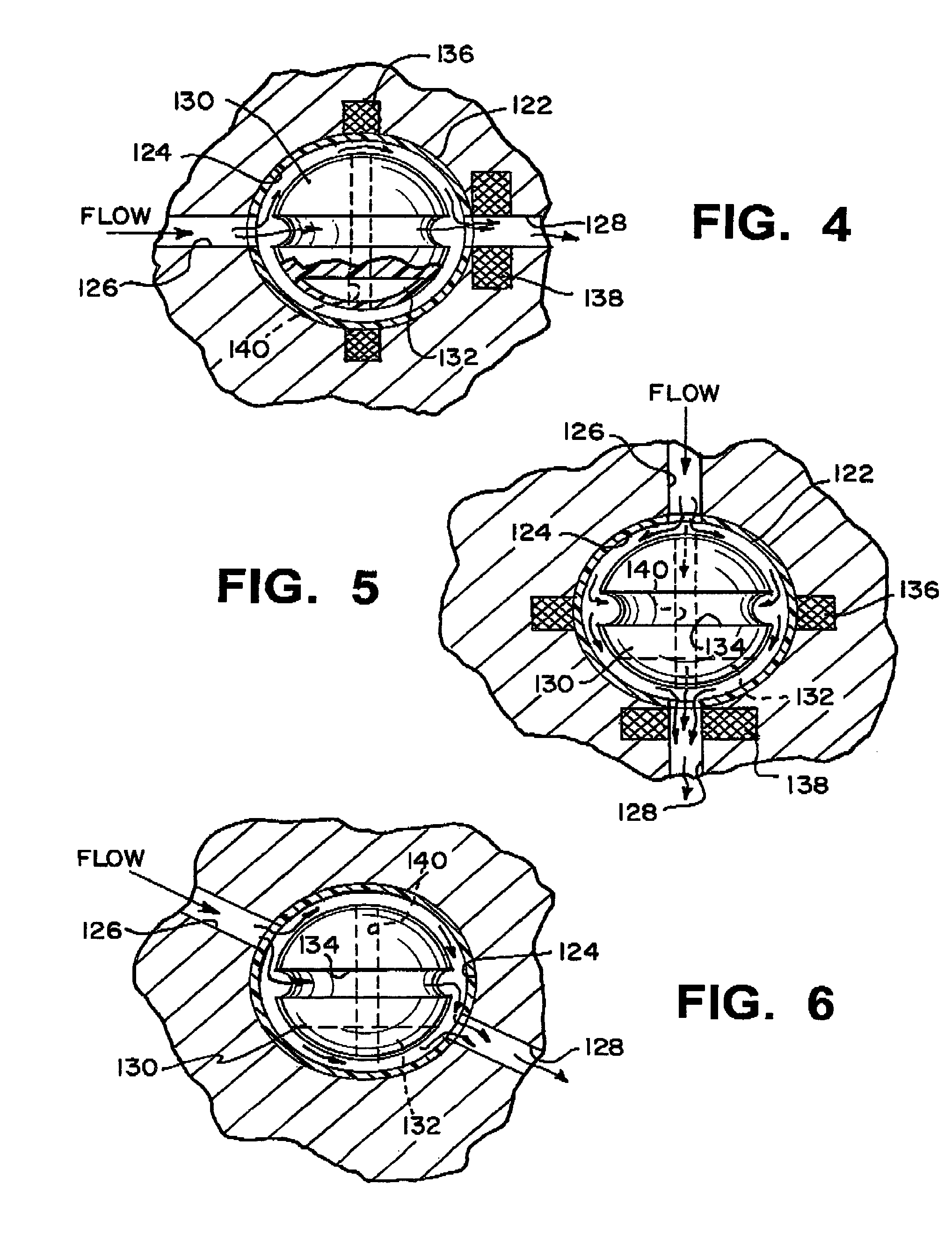 Shunt system including a flow control device for controlling the flow of cerebrospinal fluid out of a brain ventricle