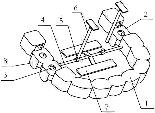 Dental implant guide plate