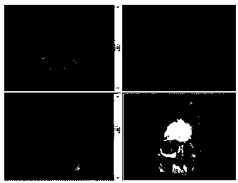 A kind of manufacturing method of skull defect repair prosthesis