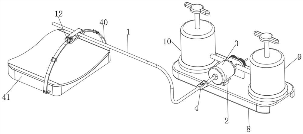 Pediatric negative pressure gastric lavage device for pediatrician