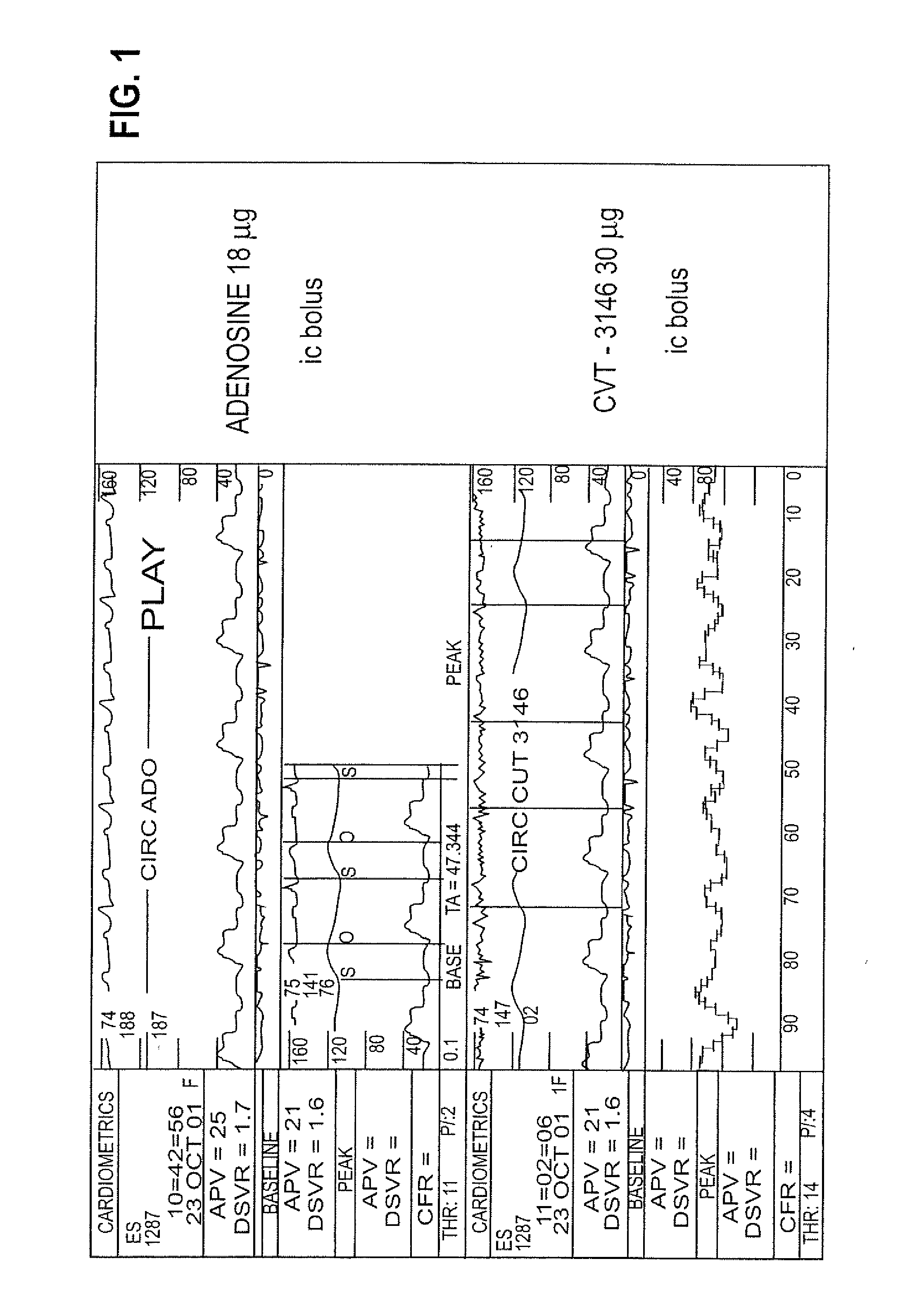 Myocardial perfusion imaging method