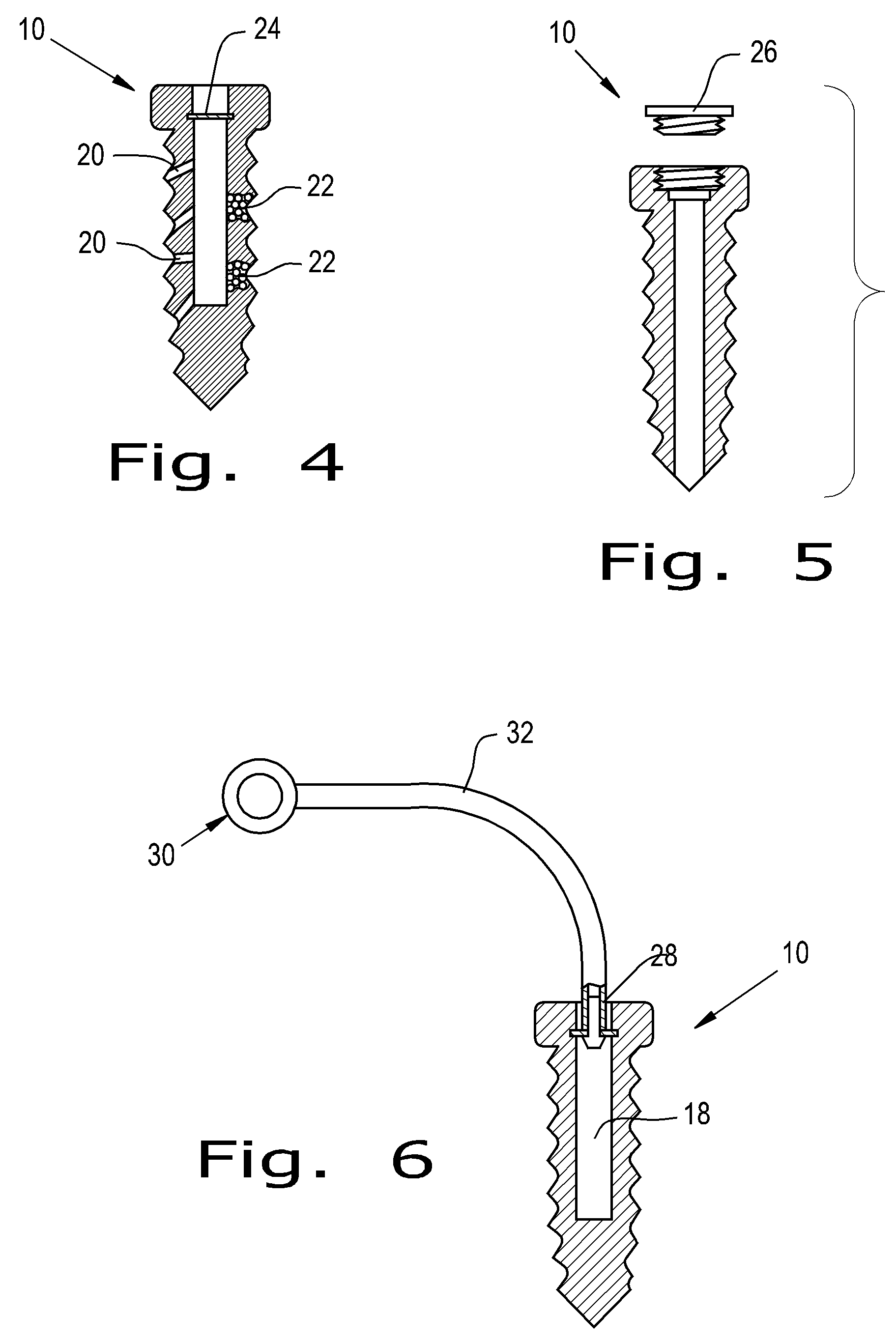 Orthopaedic screws