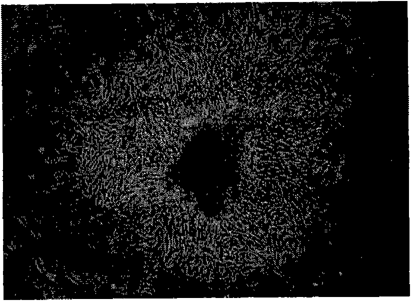 Full-implanted artificial corneal stroma and preparation method thereof