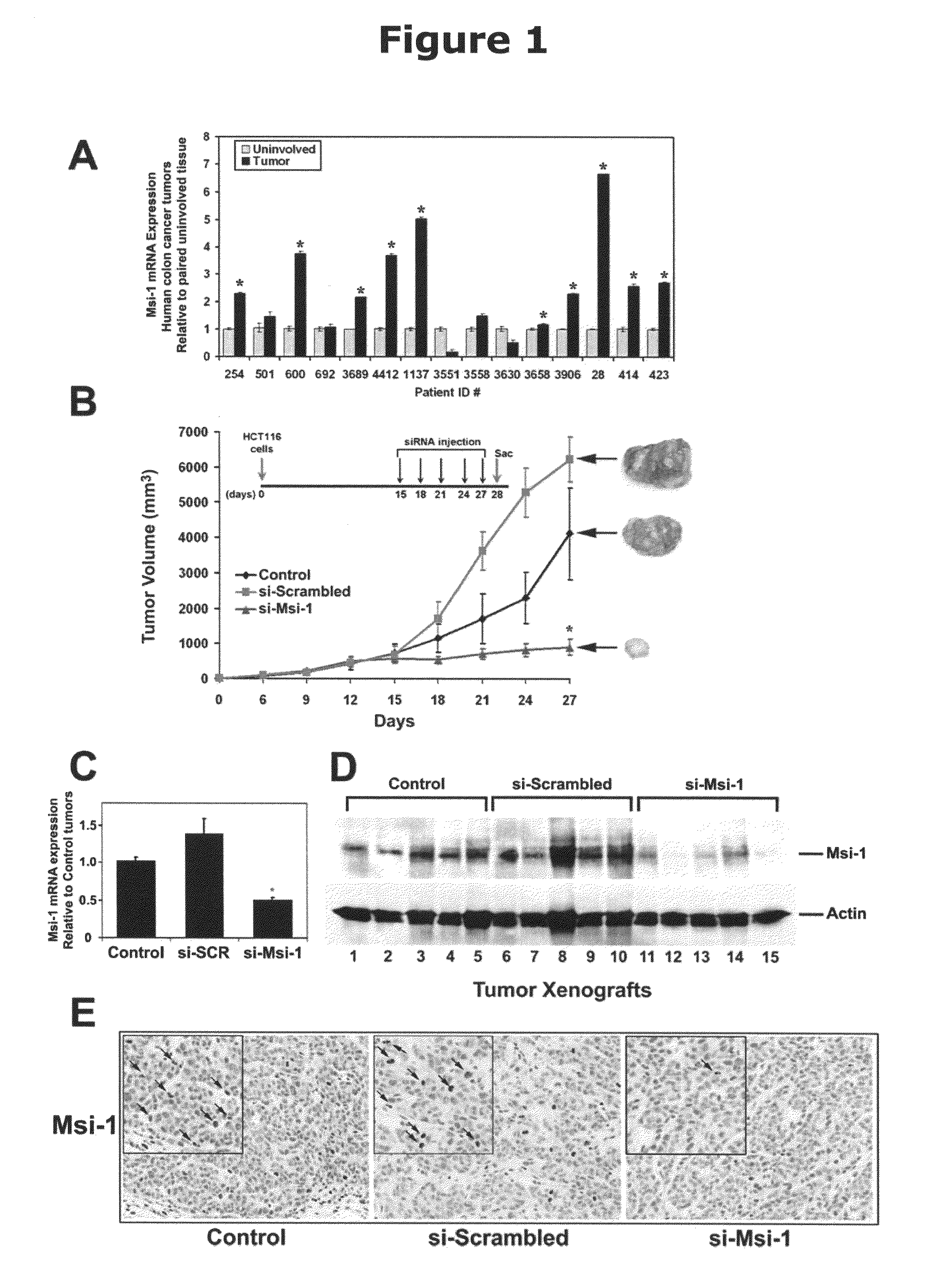 Compositions comprising inhibitors of RNA binding proteins and methods of producing and using same