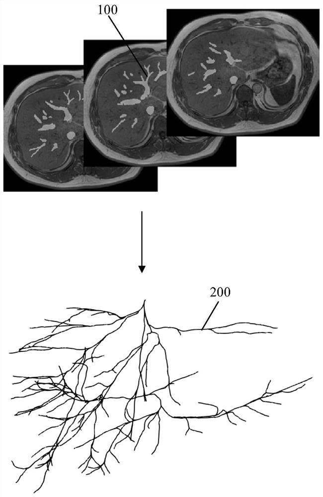 Quantitative analysis method and device for three-dimensional structural characteristics of liver vein blood vessel, computer equipment and storage medium