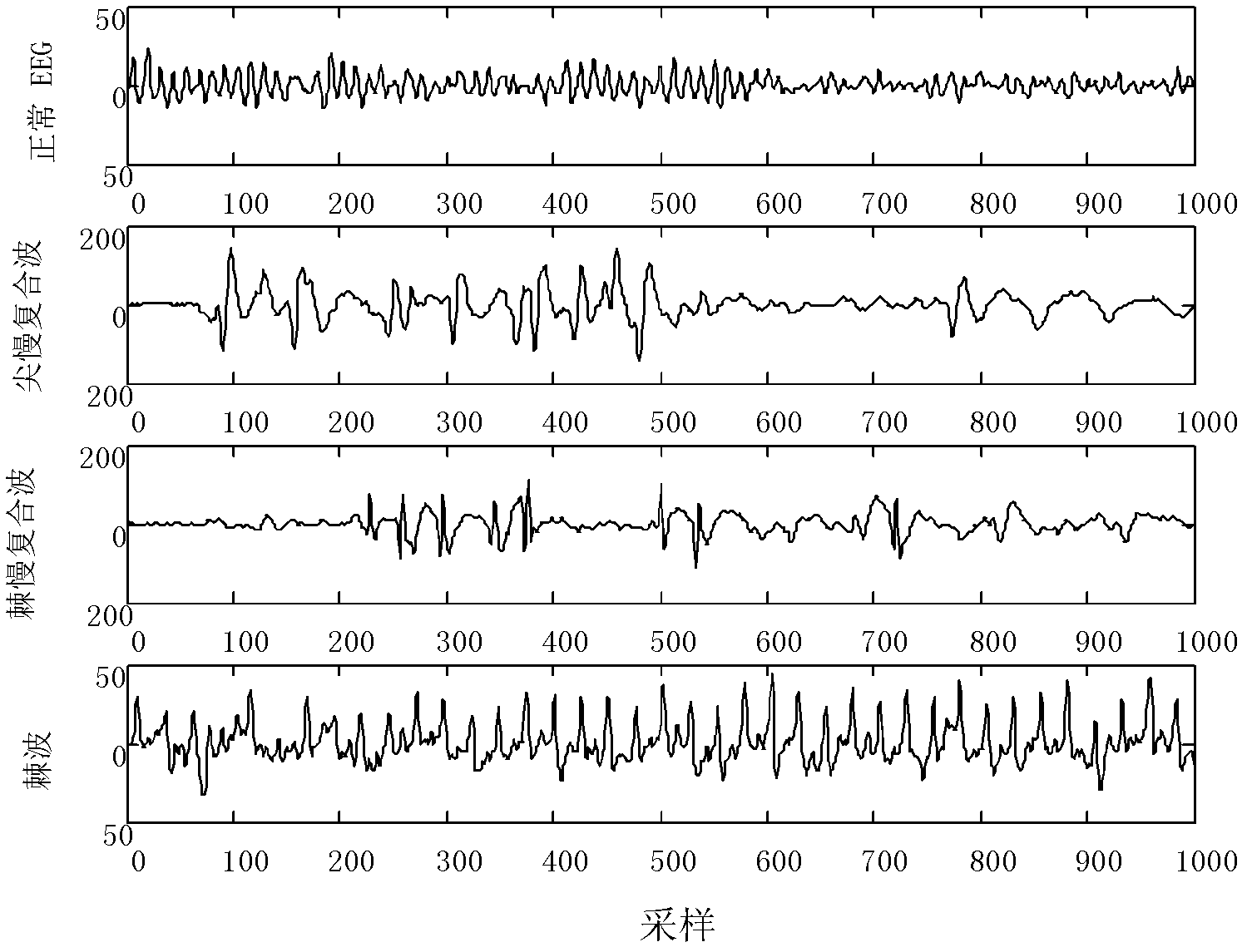 Epilepsia electroencephalogram signal classified detection device and method