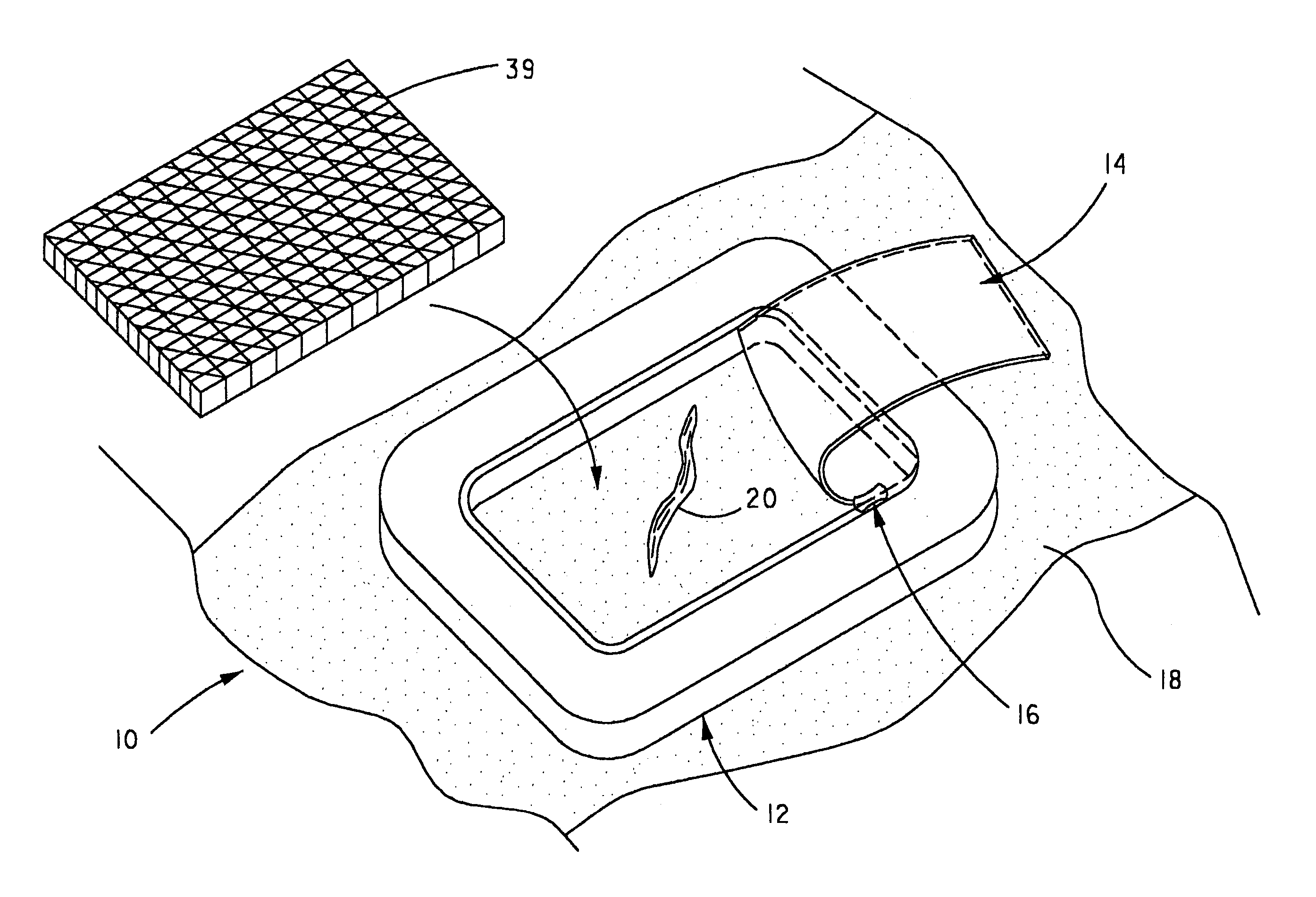 Wound dressing retainer and fastening device