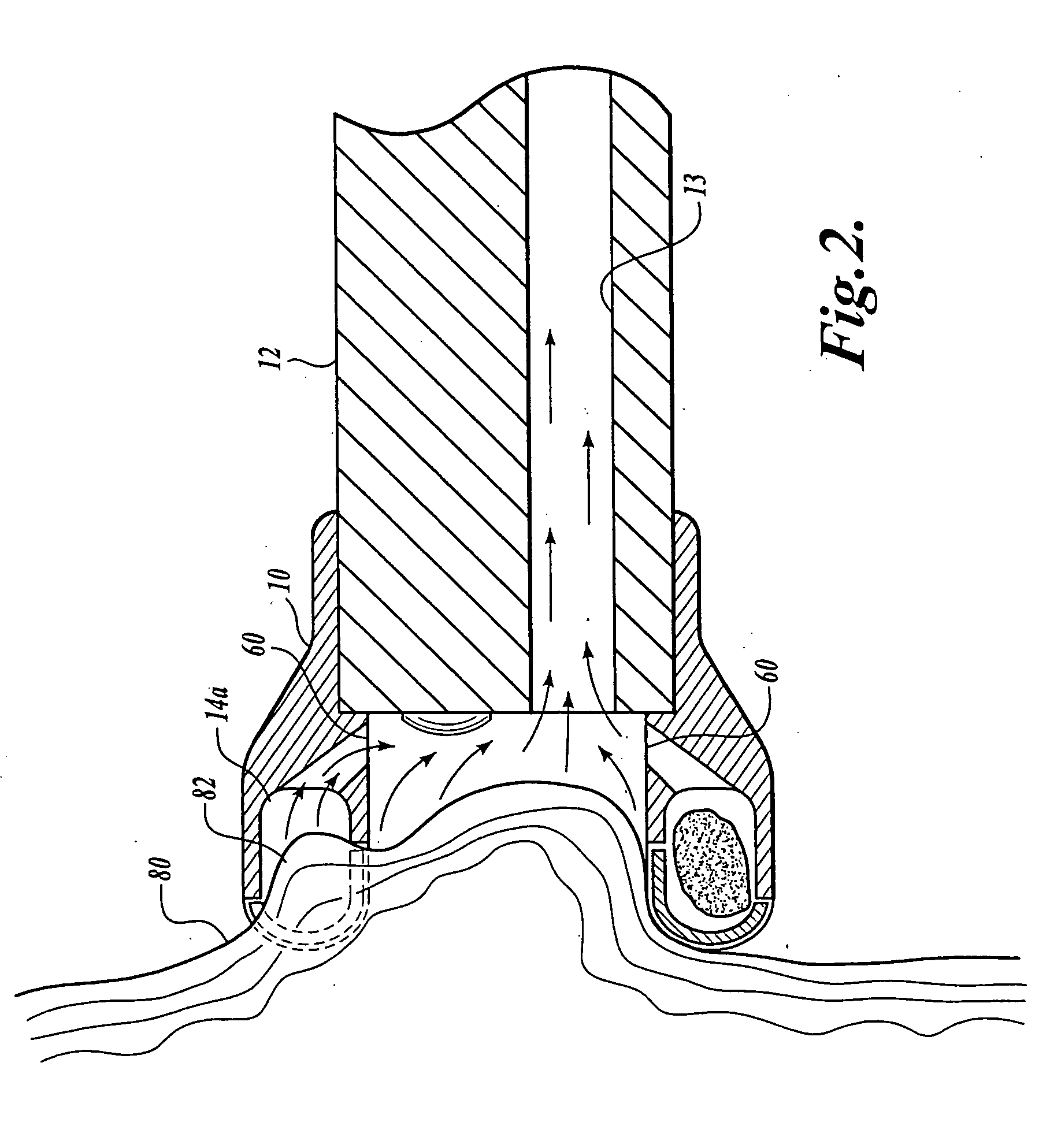 Multiple biopsy device