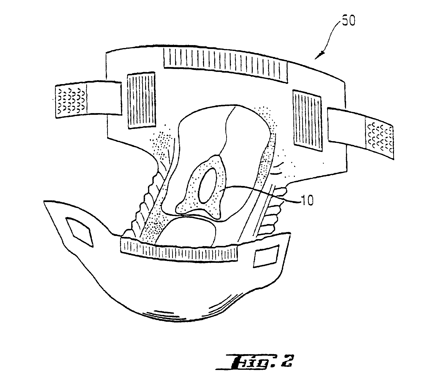 Disposable human waste management devices with improved adhesive flange to facilitate adhesion in oily conditions