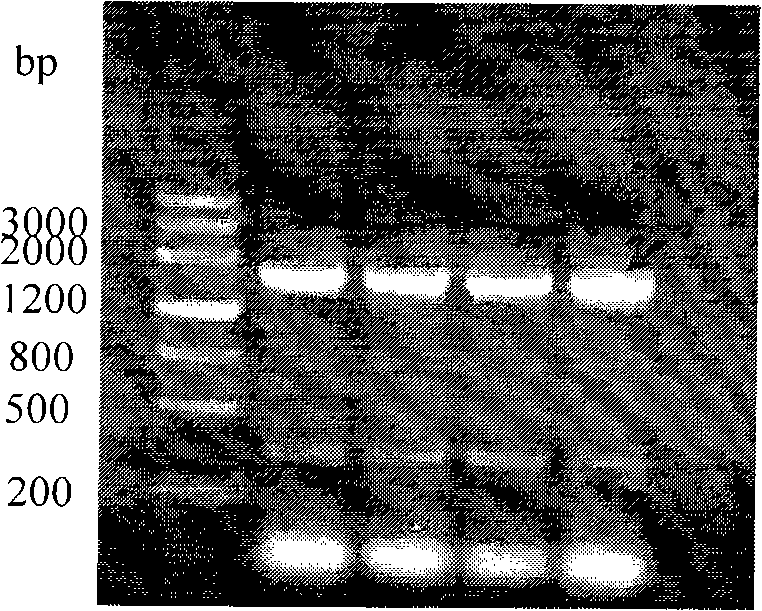 Human cystathionine beta-synthetase recombinant protein and use