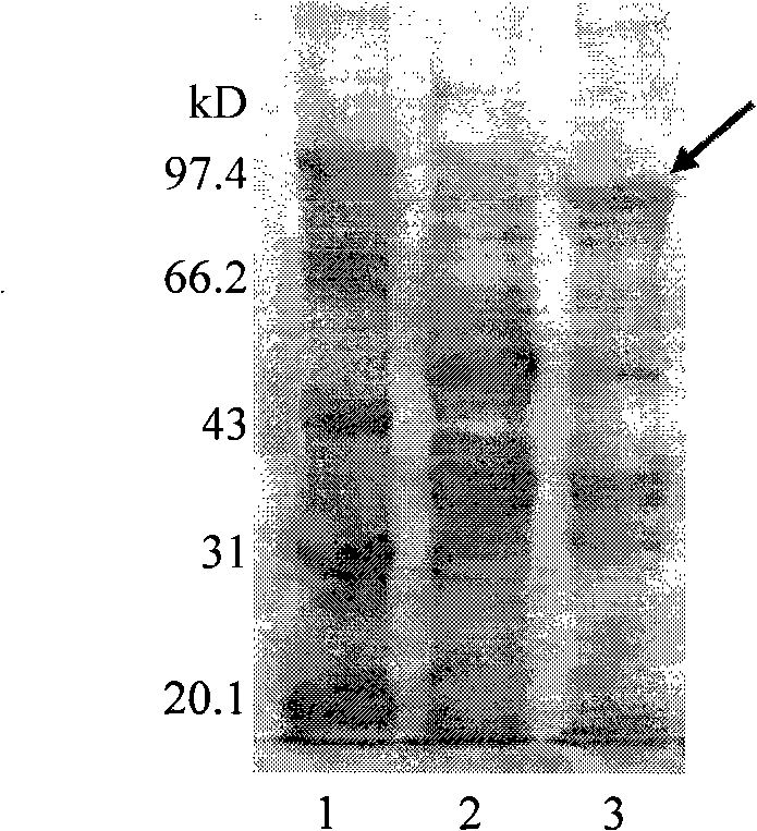 Human cystathionine beta-synthetase recombinant protein and use