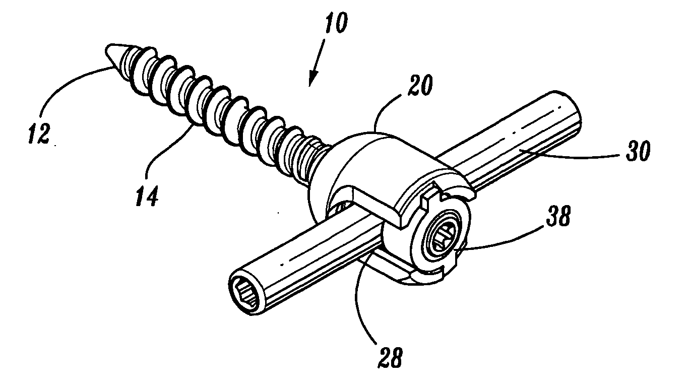 Orthopedic rod system