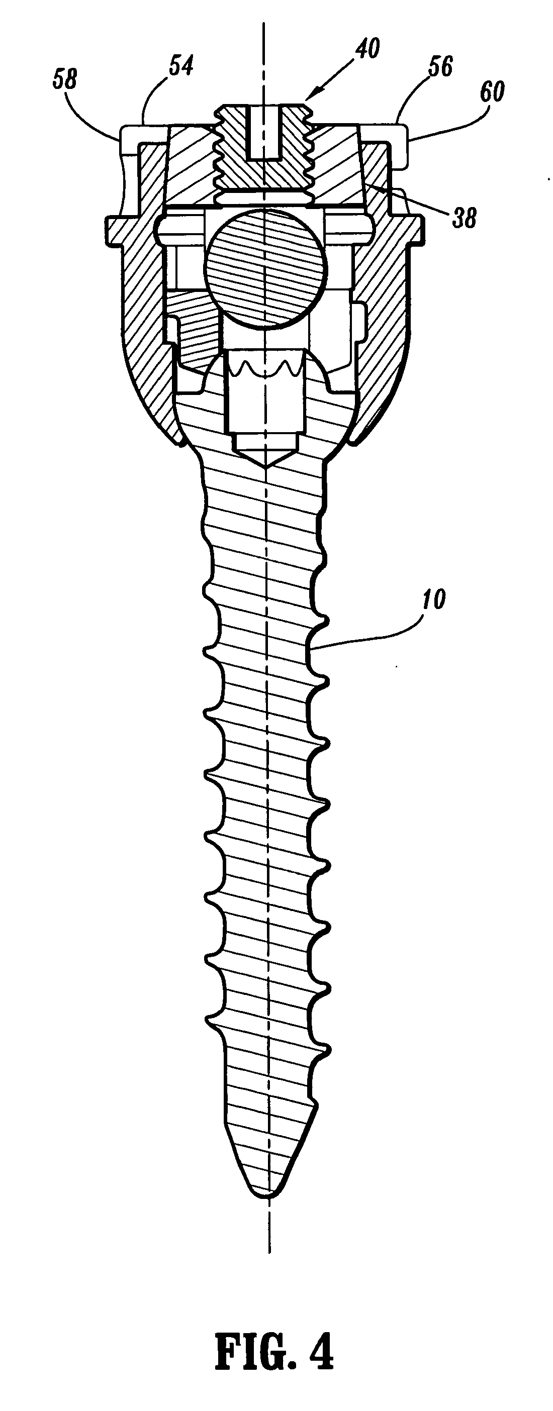 Orthopedic rod system