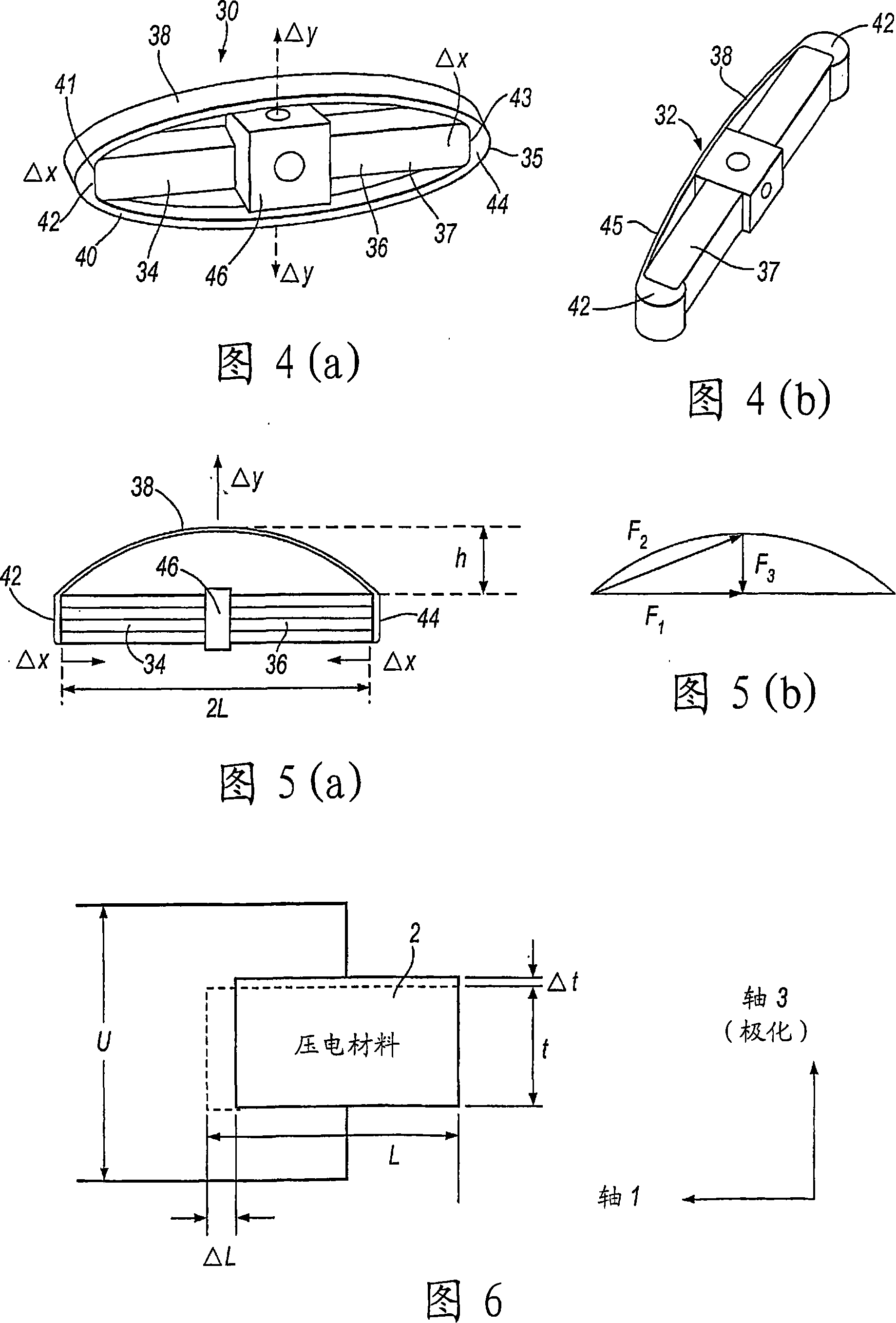 Hearing implant