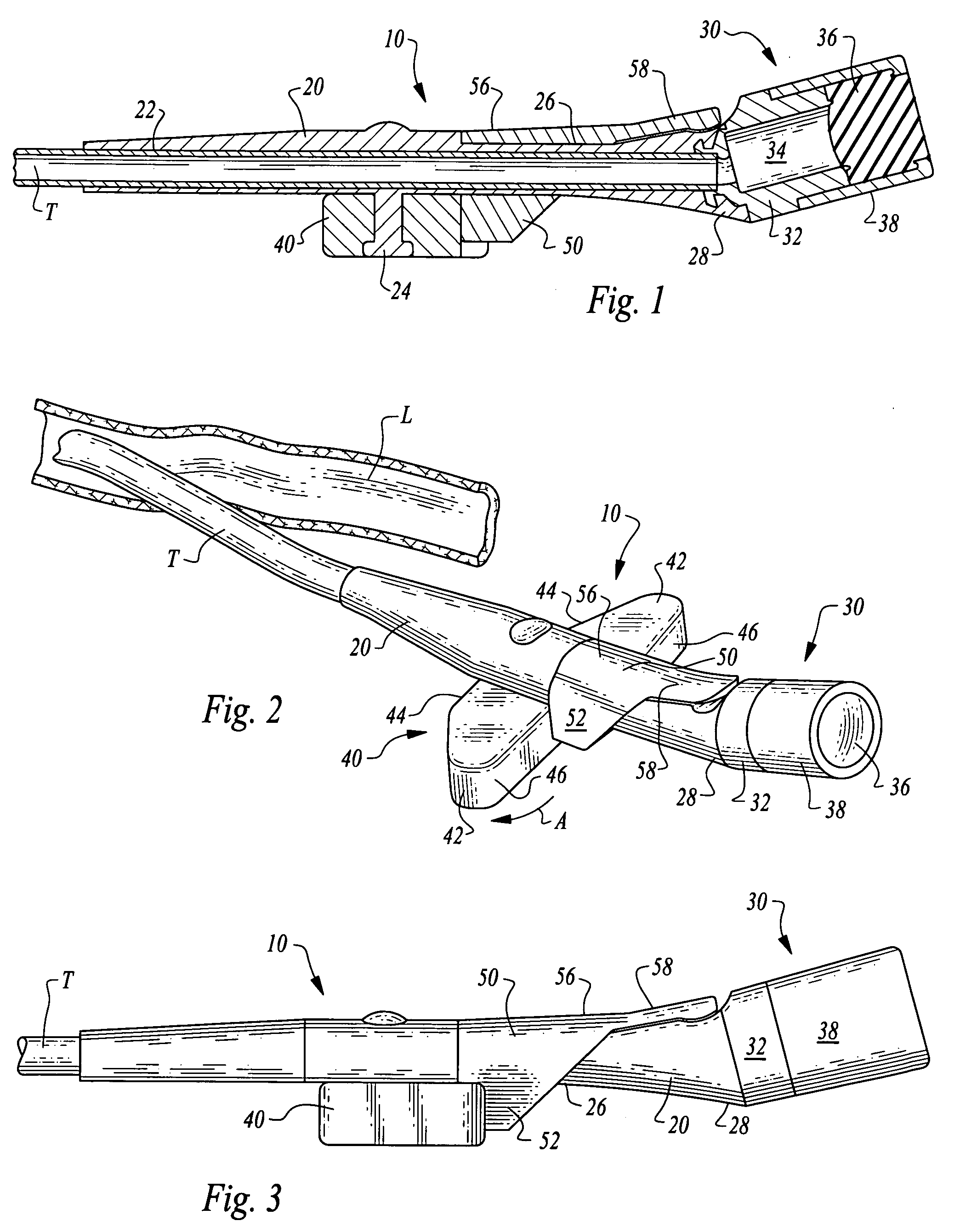 Stabilized elongate implantable vascular access device